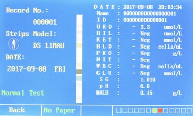 Urin-Analysator-pathologische Analyse-Ausrüstung